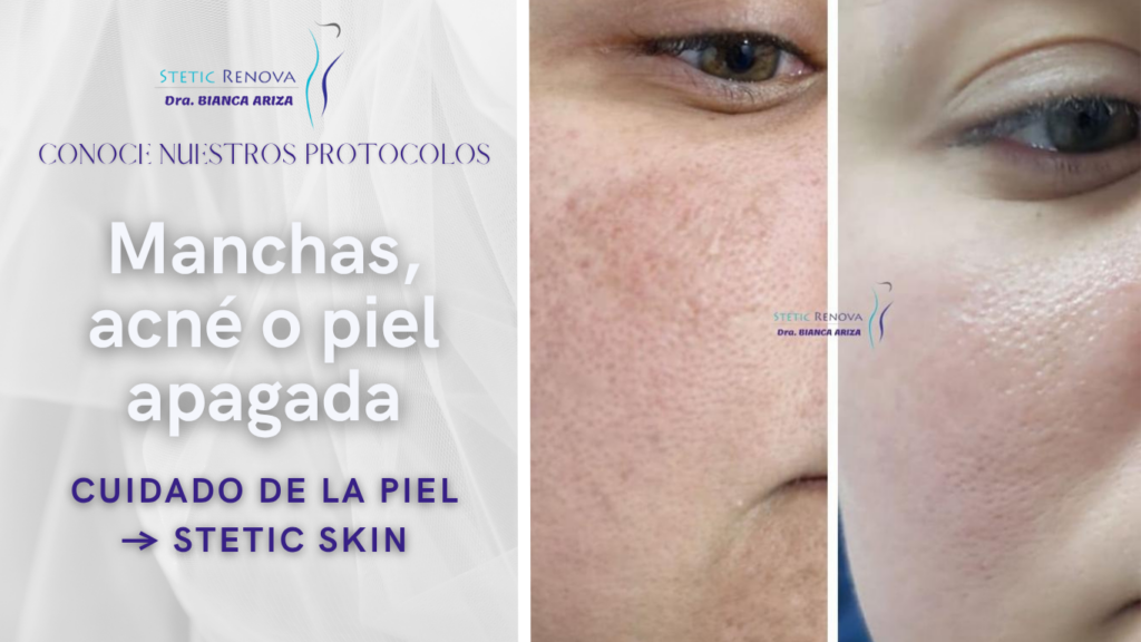 Piel Luminosa