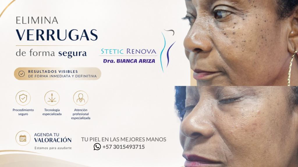 VERRUGA HORIZONTAL 1 1024x576